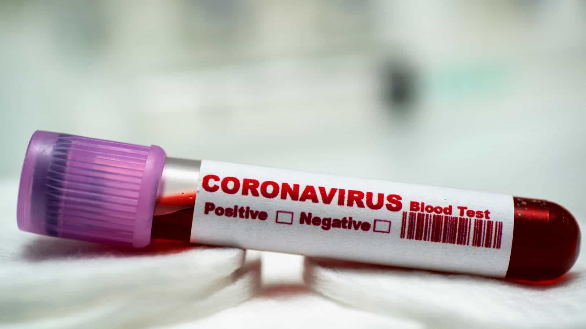 Photo of Minas Gerais tem primeira morte confirmada por novo coronavírus