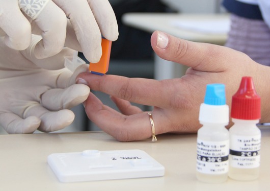 Photo of Teste rápido e profilaxia pós-exposição são estratégias na prevenção às infecções sexualmente transmissíveis